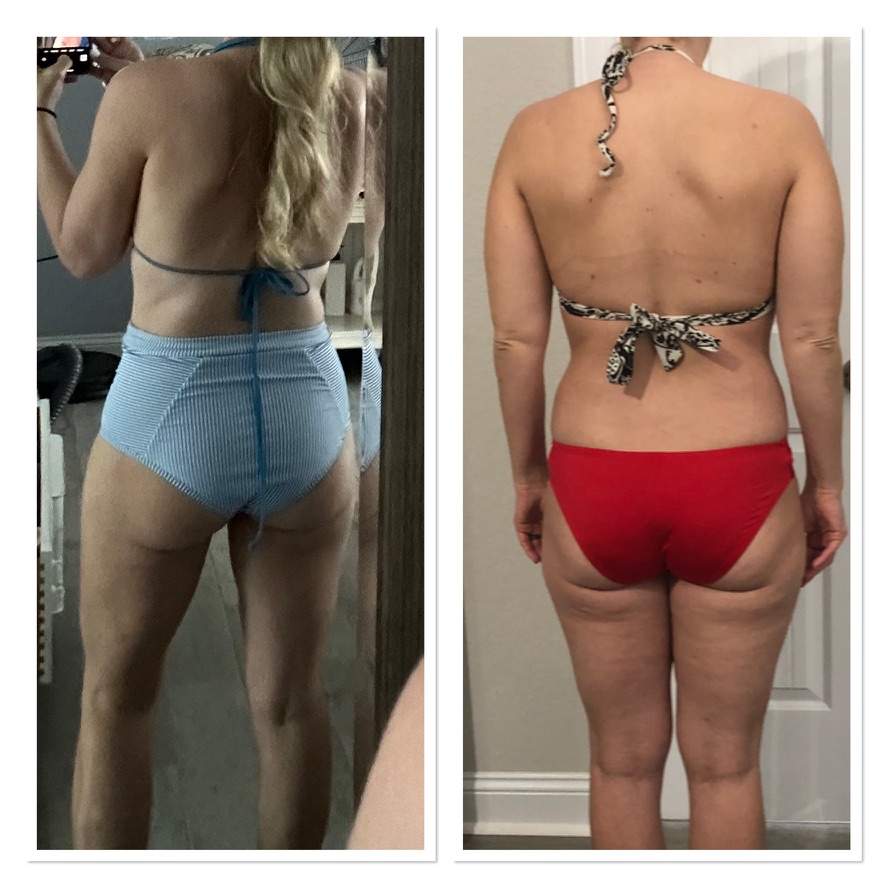 rear facing successful weight loss injection images
